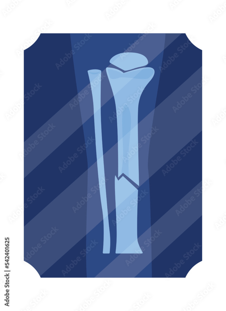 Poster radiography test semi flat color vector object. broken leg bone. editable element. full sized item o