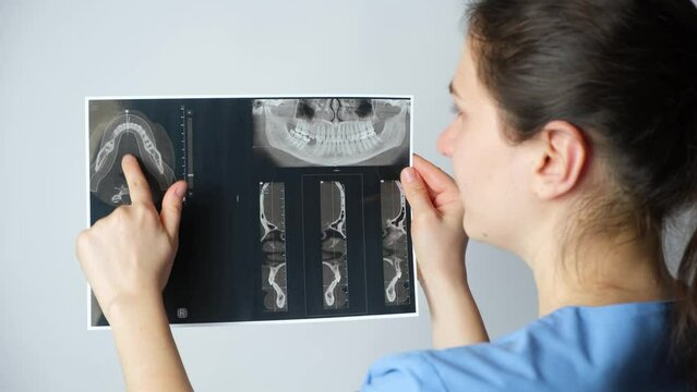 Doctor showing a CT scan of a patient with temporomandibular joint dysfunction and malocclusion.