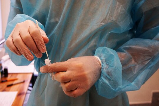 Arzt in blauem OP-Kittel hält Corona-Test in Händen 