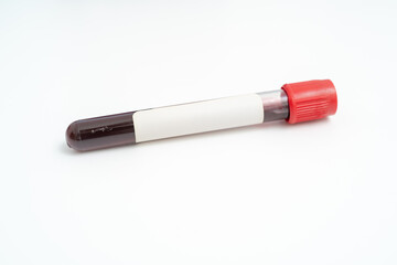 Test tube with empty label  to biological sample for medical laboratory research on white background