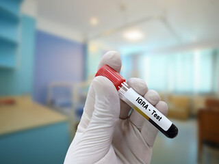 Scientist holds blood sample for IGRA (interferon gamma release assay) test for diagnosis of...