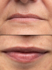 Comparison between old and young lips
