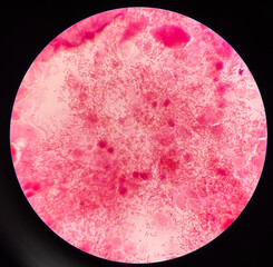 Gram neagtive bacilli on slide.