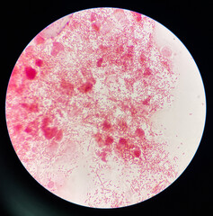 Gram neagtive bacilli on slide.