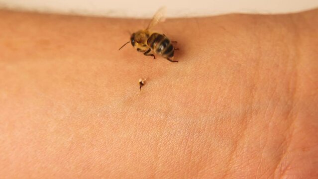 Honey bee stings a man's arm.
When the sting is over, the honeybee leaves the venom sac.
Note: It's still injecting the venom on its own (Bee's venom sac).
Honeybees.
Bees, insects, bugs.
wild nature