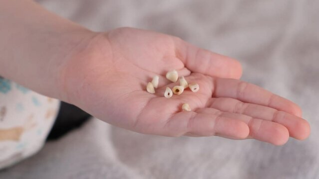The change of children's milk teeth to molars. A collection of baby teeth that have fallen out on a child's palm. Close-up.