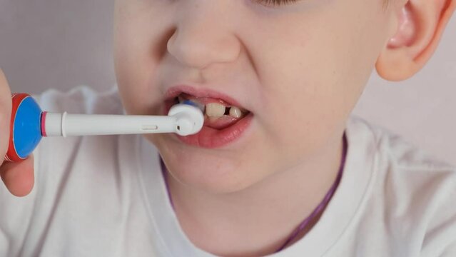 The change of children's milk teeth to molars. A child brushes his teeth with an electric toothbrush. A smile with missing teeth. Close-up.