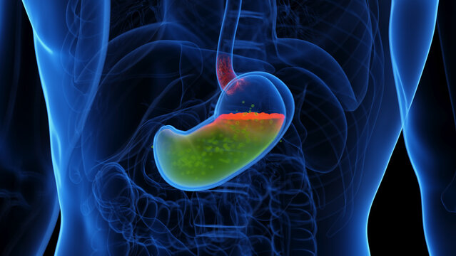 medical illustration