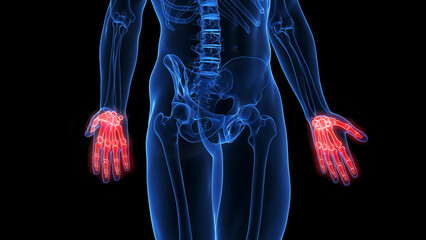 medical illustration