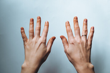 Ingrained dirt. Dirty caucasian hands isolated on a white background. Dyed palms by a fruit juice....