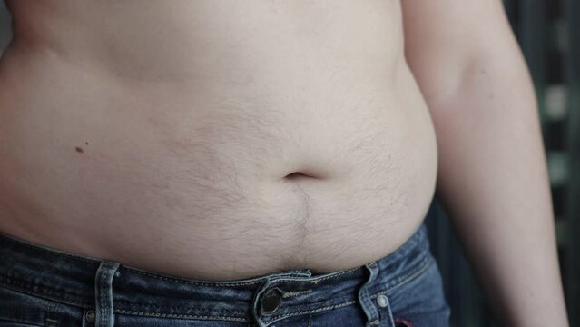 Shaking belly fat in a man. Fat folds, malnutrition and excess weight. Slow motion