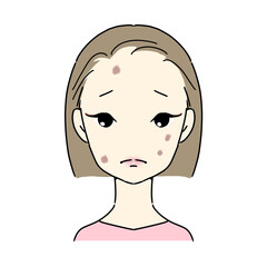 シミに悩む女性　(炎症性色素沈着)