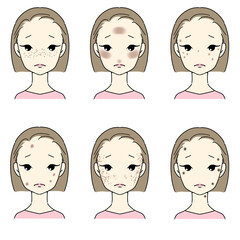 シミ・そばかすに悩む女性セット　シミの種類　文字なし