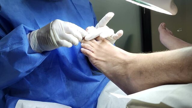Podiatrist in white gloves clean with cotton a toenail. Concept of podology and chiropody.