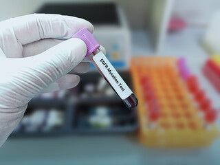 Fototapeta premium Lab Technologist holds blood sample for EGFR mutation test with laboratory background. Diagnosis of lung disease.