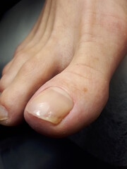 Old woman’s foot with fresh clear pedicure with glare