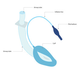 Laryngeal mask airway (LMA) structures illustration 