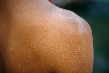 Close-up female tanned shoulder, showing skin detail with water droplets and goose bumps. Part of...