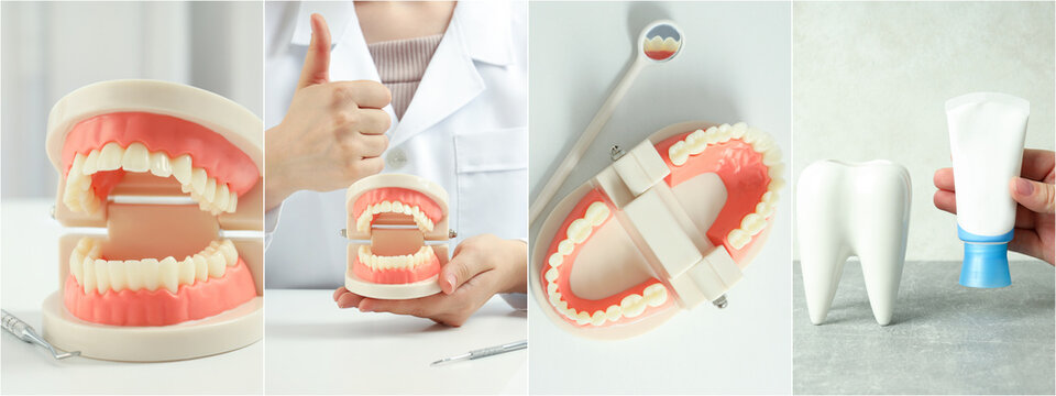 Collage of photos for Teeth treatment concept