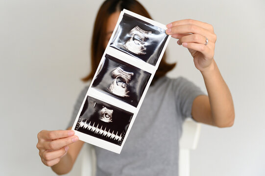Pregnant Asian woman holding and showing sonogram or ultrasonography picture of her unborn baby