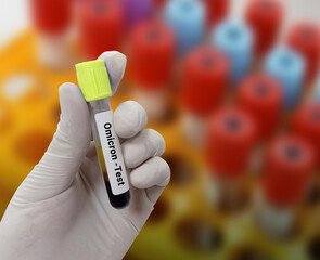 Lab Technologist holds blood sample for Omicron test. Omicron B.1.1.529 test with laboratory...