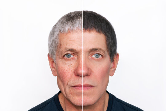 Comparison of the face of young and aged men. Youth, old age. The process of aging and rejuvenation, the result years later. Beauty treatments and lifting. Age-related changes,appearance of wrinkles