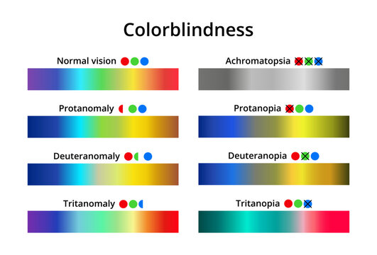 Vector illustration of color blindness or colorblindness. Normal vision, achromatopsia, protanomaly, protanopia, tritanomaly, tritanopia, deuteranomaly, deuteranopia. Color vision deficiency spectrum.