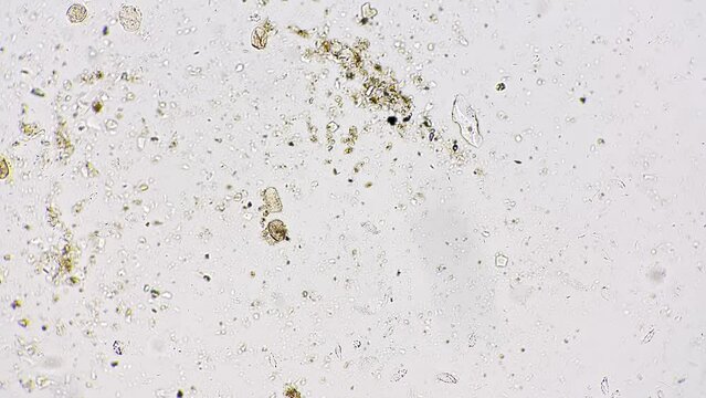 Zygote of ascarid lumbricoide whole mount filmed under microscope 100x on bright field background. Macro view of roundworm living in humans. Educating dangerous parasites in medical laboratory