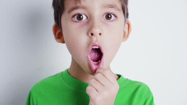 boy child in a green T-shirt shows his mouth without front baby teeth and shows a tooth to the camera , standing on a white background to the room