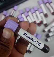Blood sample for Manganese (Mn) test, to evaluate central nervous system, blood toxicity test....