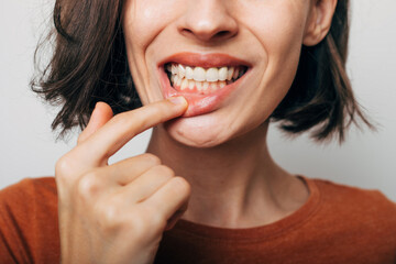 Close up shot of gum inflammation. Cropped shot of a young woman showing red bleeding gums isolated on a gray background. Dentistry, dental care - obrazy, fototapety, plakaty