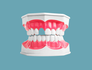 Tooth loss concept. Missing teeth in jaw model on background. Dentistry problems. Gap, absence