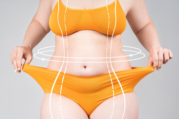 Full body liposuction, legs, hips, abdomen and breast augmentation, fat and cellulite removal...