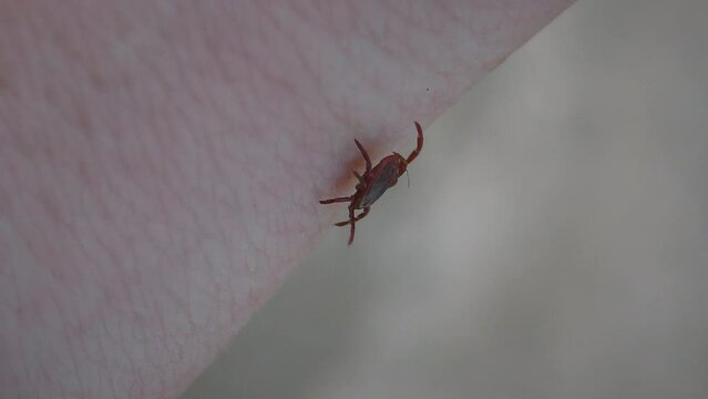 A dangerous parasite Hard tick or Scale tick (Ixodes sp.) crawls on human skin.