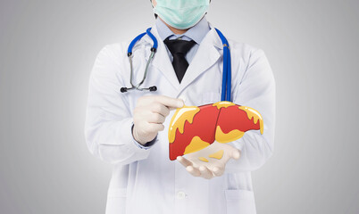 doctor showing fatty liver , liver disease - obrazy, fototapety, plakaty