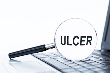 Medical and ulcer symbol. Magnifying glass with the concept word ulcer on beautiful white background. Doctor hand. Medical and ulcer concept, copy space.