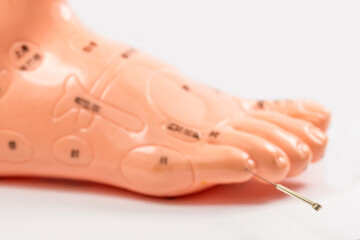 Acupuncture needle in acupuncture foot model