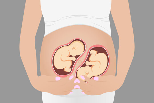 Pregnant Woman With Twins In The Womb. Vector Illustration