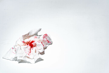 Coughing blood (Hemoptysis) or nose bleed on a white tissue paper. This can be from pneumonia, lung...