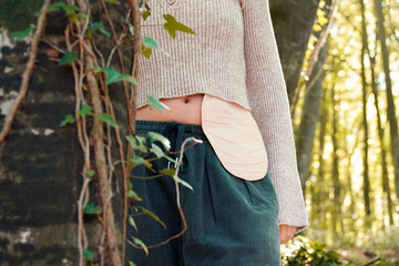 abdomen of a girl with an colostomy bag hidden behind a tree with a background of beech trees
