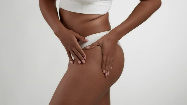 Skin problems. Close up shot of unrecognizable black woman in underwear showing cellulitis on her hips, slow motion