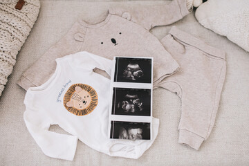 Ultrasounds and cute baby things. The concept of conscious parenthood, happy motherhood and easy pregnancy.