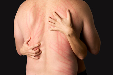 Woman scratches Man's back isolated on black background