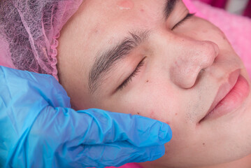 An Esthetician spreads clear serum to the face of a customer. Facial rejuvenation procedure at a...