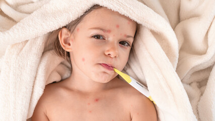 Close-up of little girl with chickenpox lying in bed and measuring temperature