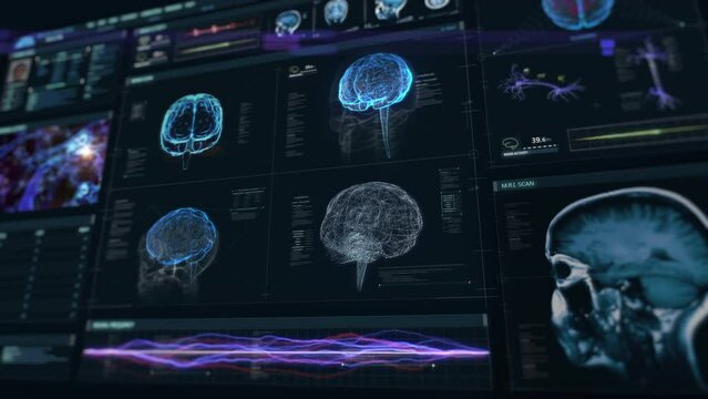 
Futuristic HUD Interface Showing Brain and Neurons Of Anatomy and MRI Information. Illness Analysis Interface Scans Human Brain Organ. Examination Software Diagnostic. EKG and Vital Signs. Healthcare