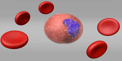 Erythroid leukemia, 3d render illustration