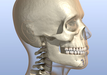 Chin Reduction (Osseous Genioplasty) surgery. Medically accurate dental 3D illustration.
