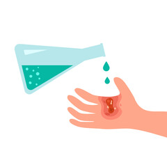 Chemical acid burn on hand skin in flat design on white background.