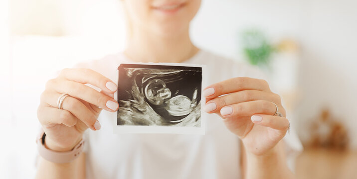 Closeup ultrasound scan of baby in hands of pregnant young woman, light background